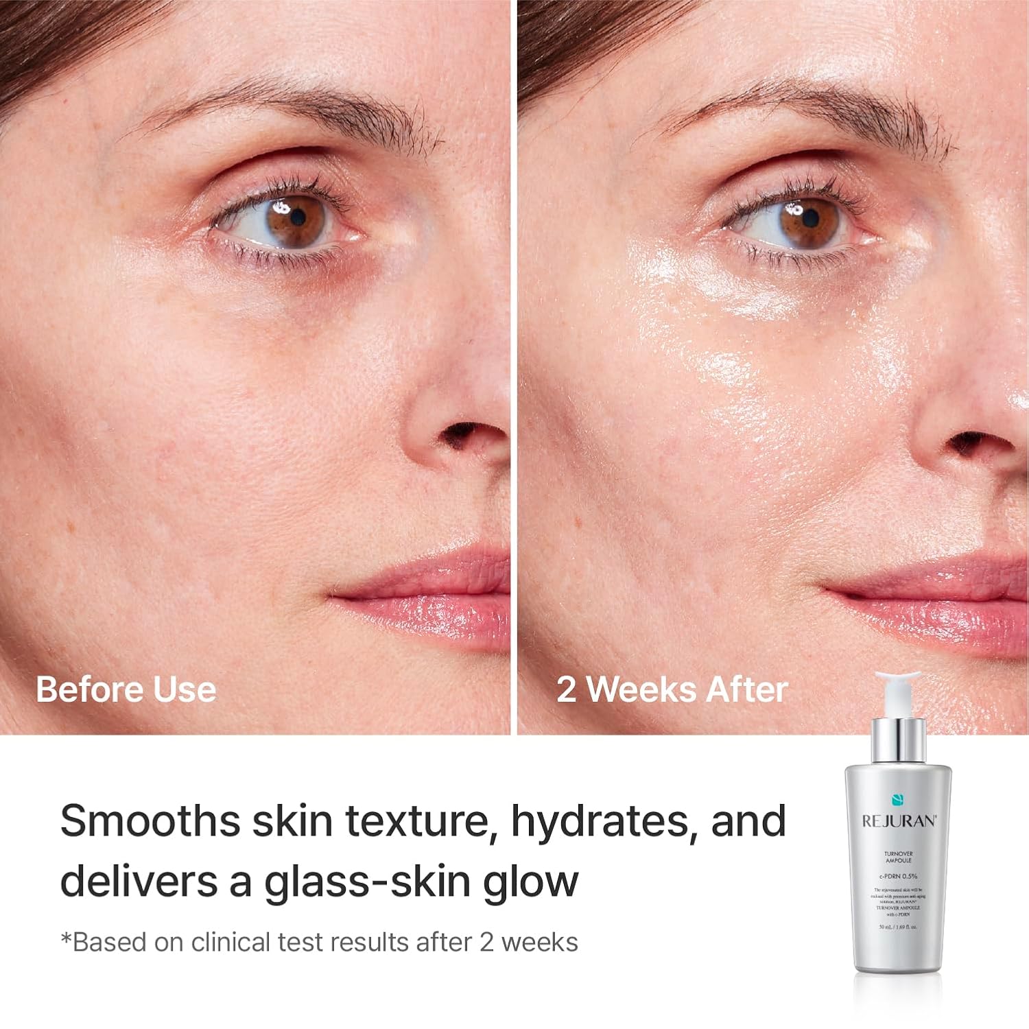 Rejuran Turnover Ampoule 50ml	